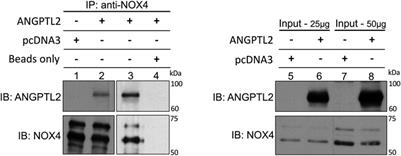 Knockdown of ANGPTL2 promotes left ventricular systolic dysfunction by upregulation of NOX4 in mice