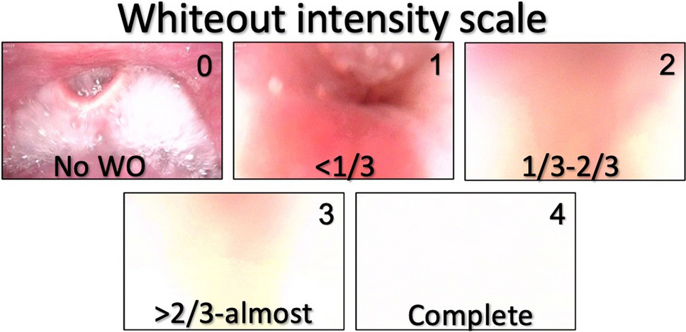 Evaluation of the Whiteout During Fiberoptic Endoscopic Evaluation of Swallowing and Examination of Its Correlation with Pharyngeal Residue and Aspiration