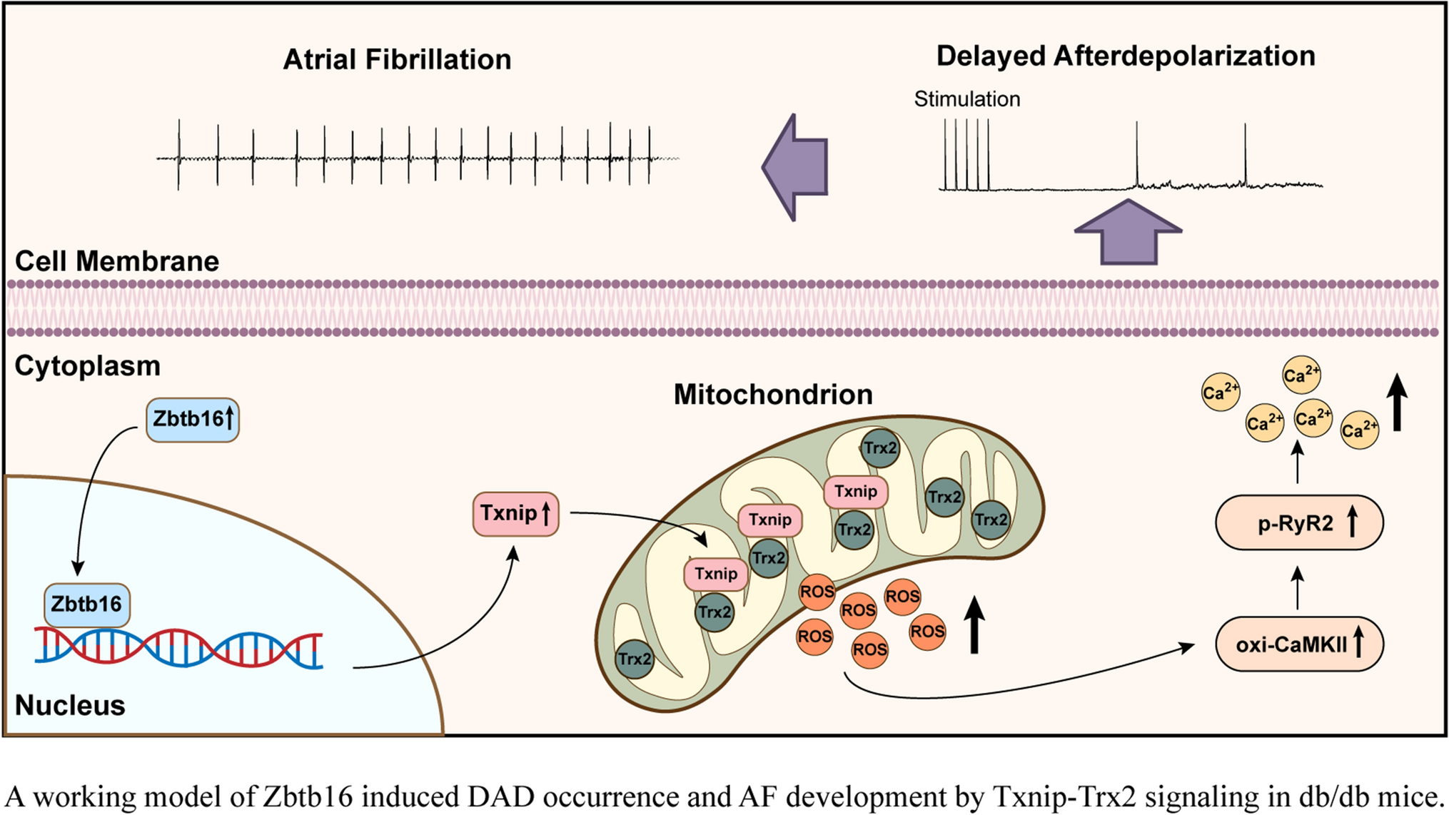 Zbtb16 increases susceptibility of atrial fibrillation in type 2 diabetic mice via Txnip-Trx2 signaling