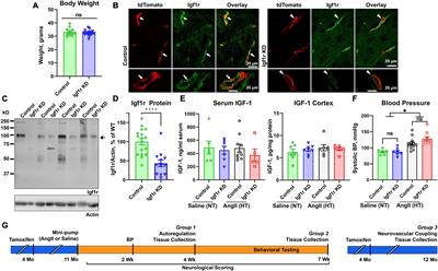 IGF1R deficiency in vascular smooth muscle cells impairs myogenic autoregulation and cognition in mice