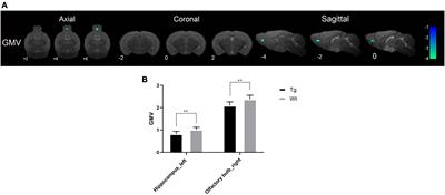 Preliminary study on early diagnosis of Alzheimer’s disease in APP/PS1 transgenic mice using multimodal magnetic resonance imaging