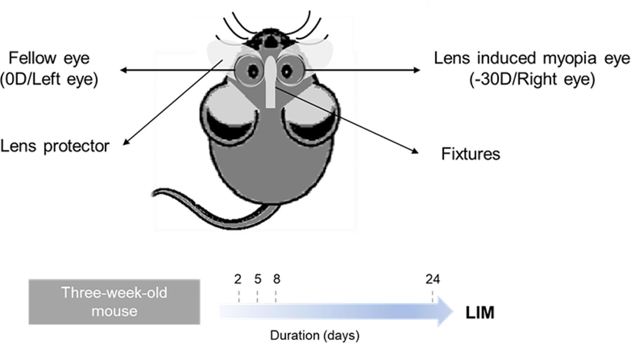Scleral remodeling during myopia development in mice eyes: a potential role of thrombospondin-1