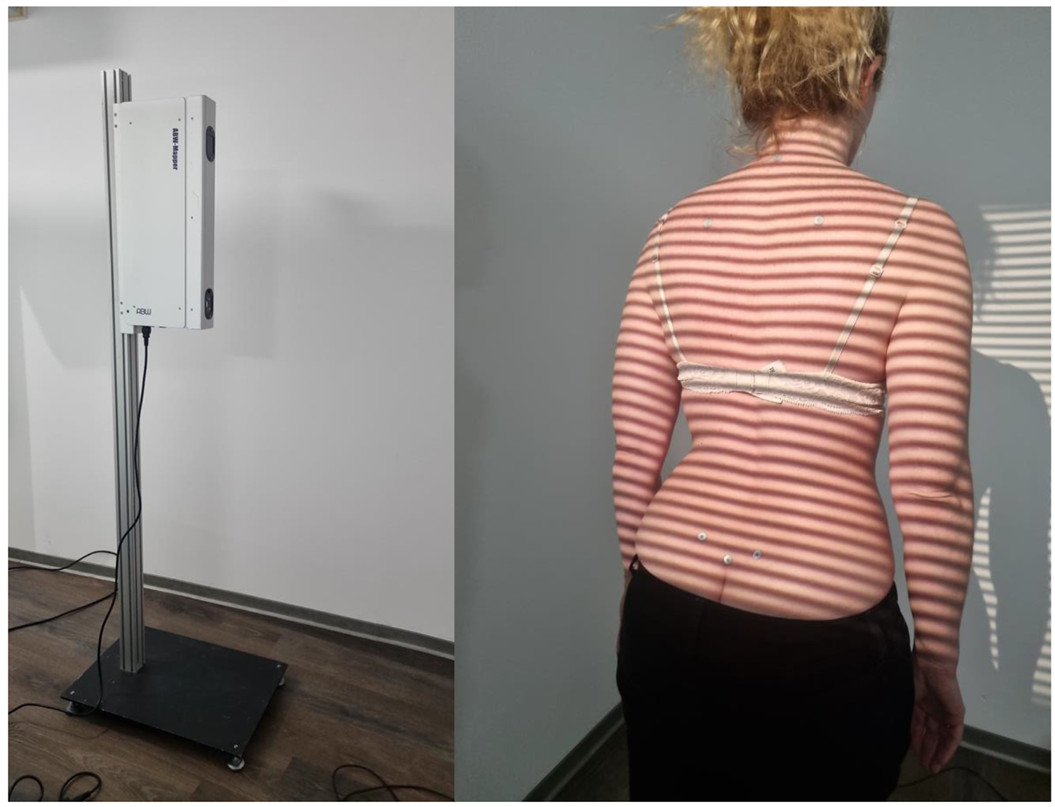 Differences in upper body posture between patients with lumbar spine syndrome and healthy individuals under the consideration of sex, age and BMI