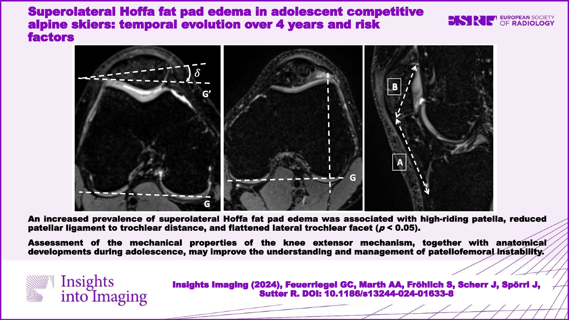 Superolateral Hoffa fat pad edema in adolescent competitive alpine skiers: temporal evolution over 4 years and risk factors