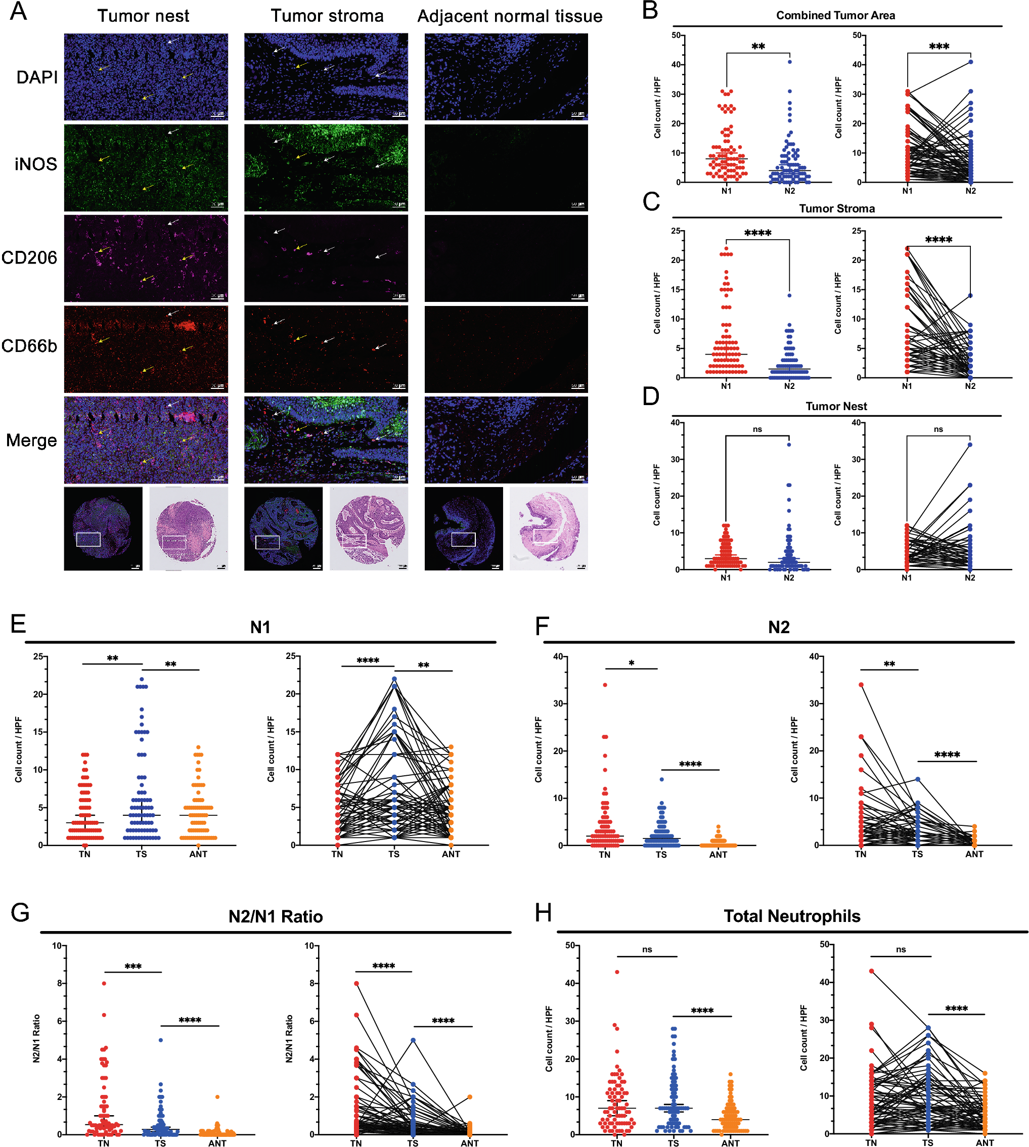 Prognostic significance and immune escape implication of tumor-infiltrating neutrophil plasticity in human head and neck squamous cell carcinoma