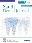 Is fatigue mechanism implicated in intraoral fracture of narrow dental implants? A thorough retrieval analysis of two failed implant fixtures retrieved from a single patient