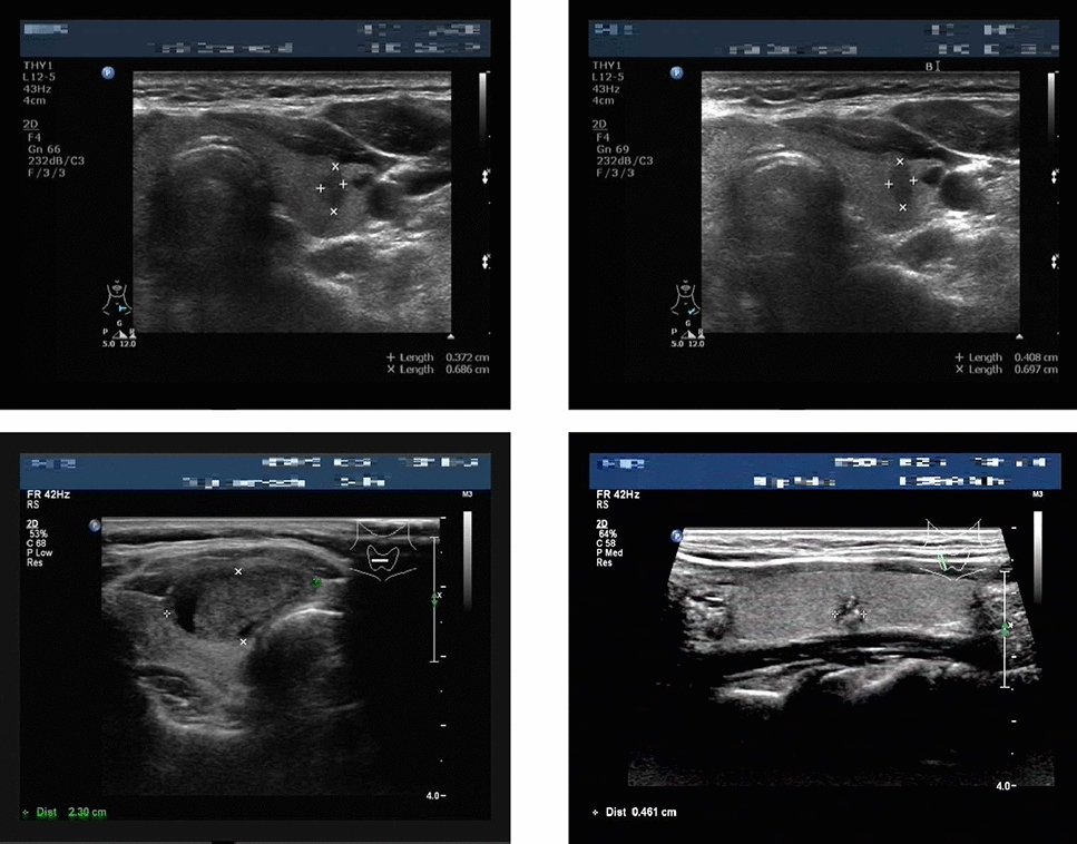 A multi-task model for reliable classification of thyroid nodules in ultrasound images