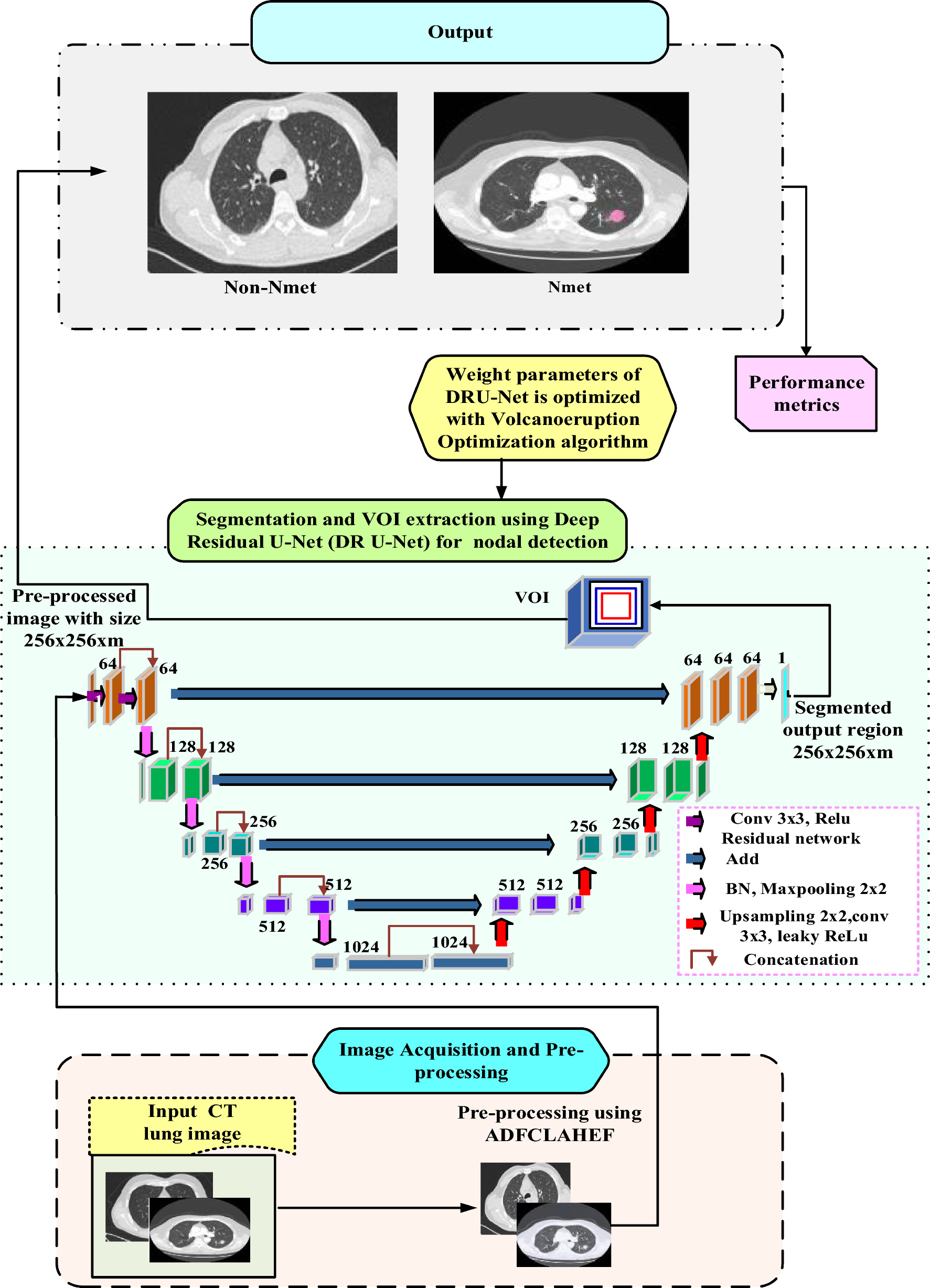 Deep volcanic residual U-Net for nodal metastasis (Nmet) identification from lung cancer