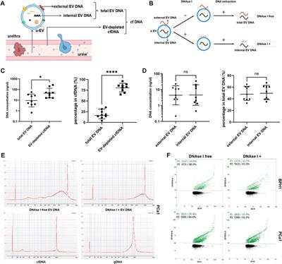 Influential factors on urine EV DNA methylation detection and its diagnostic potential in prostate cancer