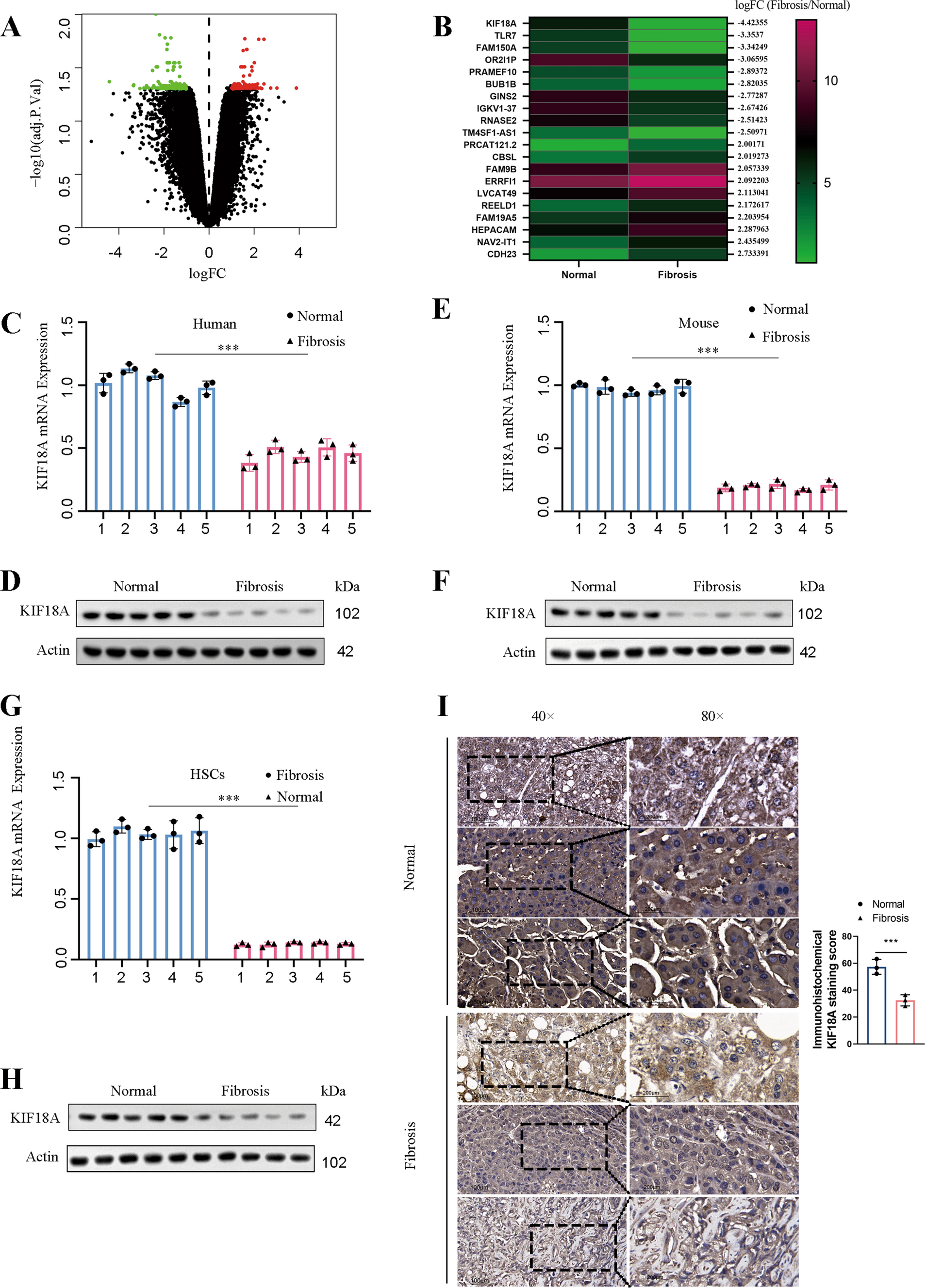 KIF18A inactivates hepatic stellate cells and alleviates liver fibrosis through the TTC3/Akt/mTOR pathway