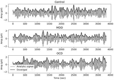 Long-range temporal correlations in resting state alpha oscillations in major depressive disorder and obsessive-compulsive disorder