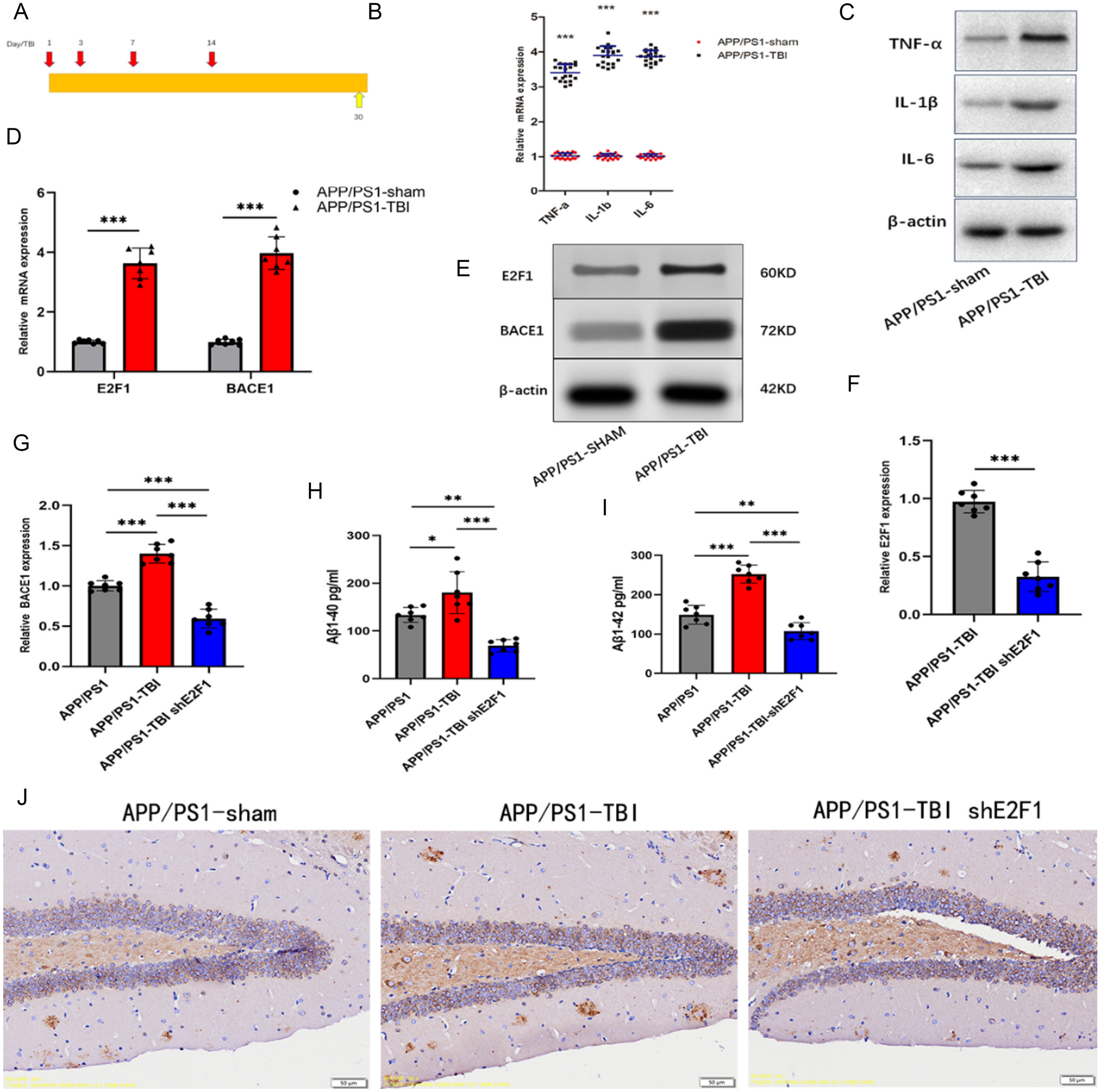 E2F1 Mediates Traumatic Brain Injury and Regulates BDNF-AS to Promote the Progression of Alzheimer’s Disease