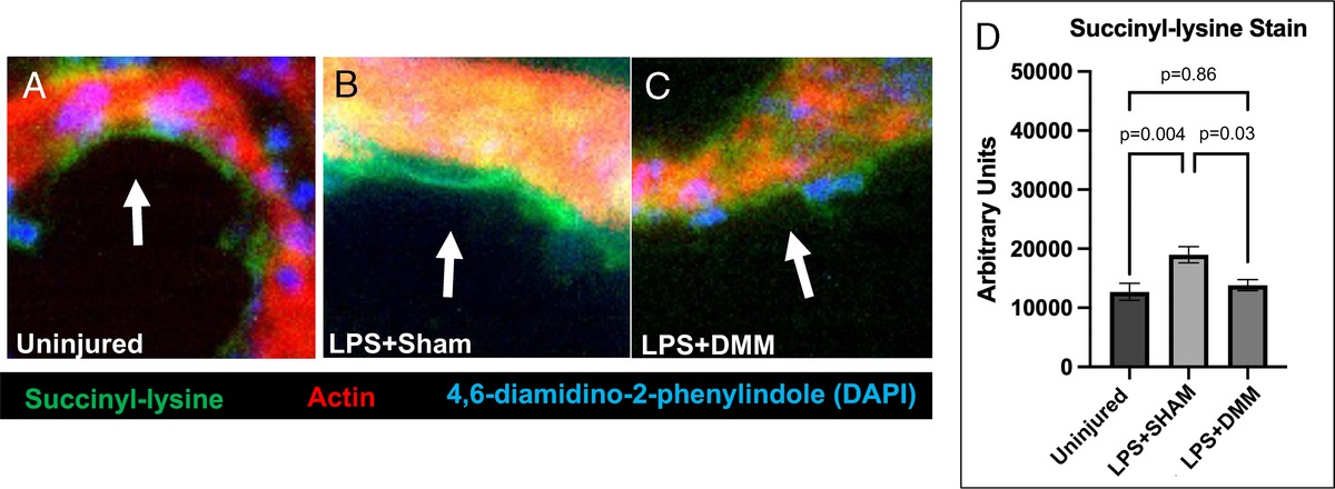 Dimethyl malonate protects the lung in a murine model of acute respiratory distress syndrome
