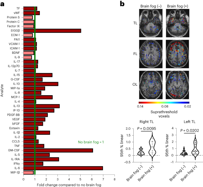 Leaky blood–brain barrier in long-COVID-associated brain fog