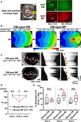 Myofibroblasts impair myocardial impulse propagation by heterocellular connexin43 gap-junctional coupling through micropores