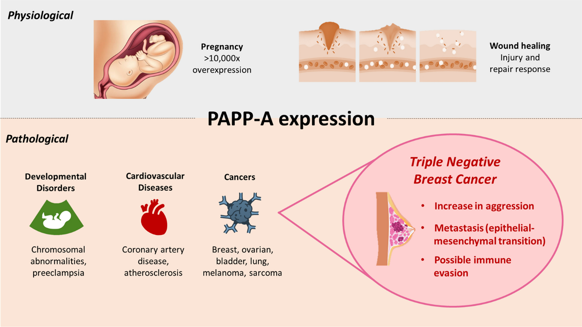 The role of pregnancy associated plasma protein-A in triple negative breast cancer: a promising target for achieving clinical benefits