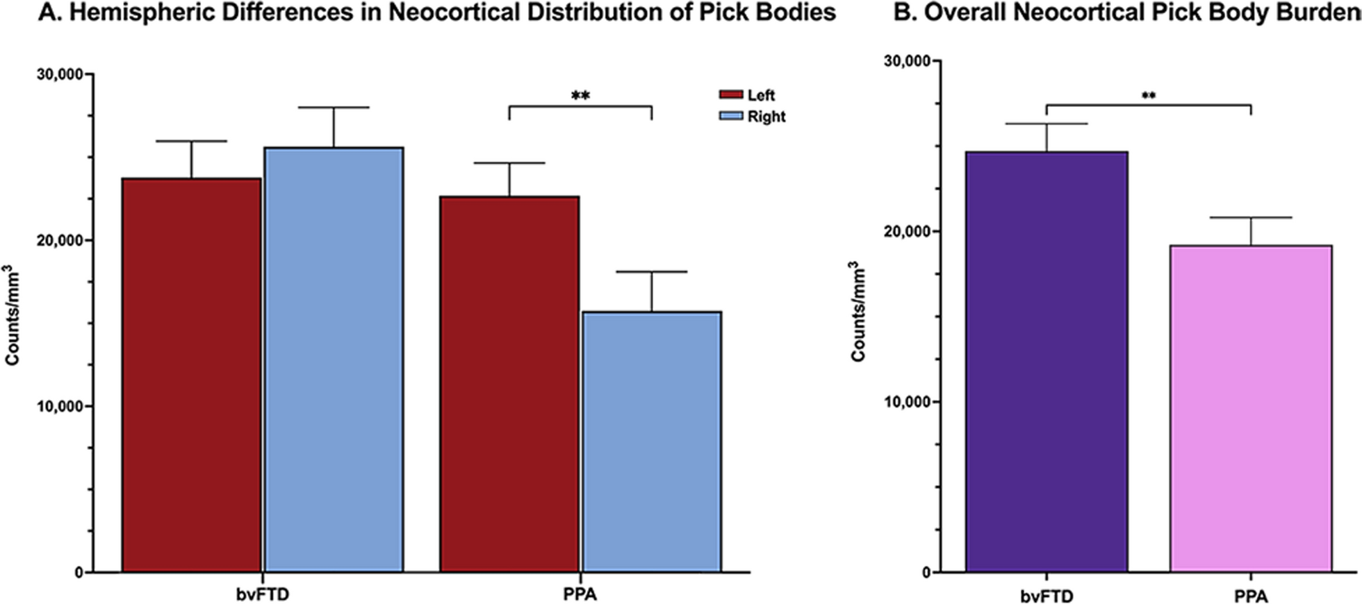 Phenotypically concordant distribution of pick bodies in aphasic versus behavioral dementias