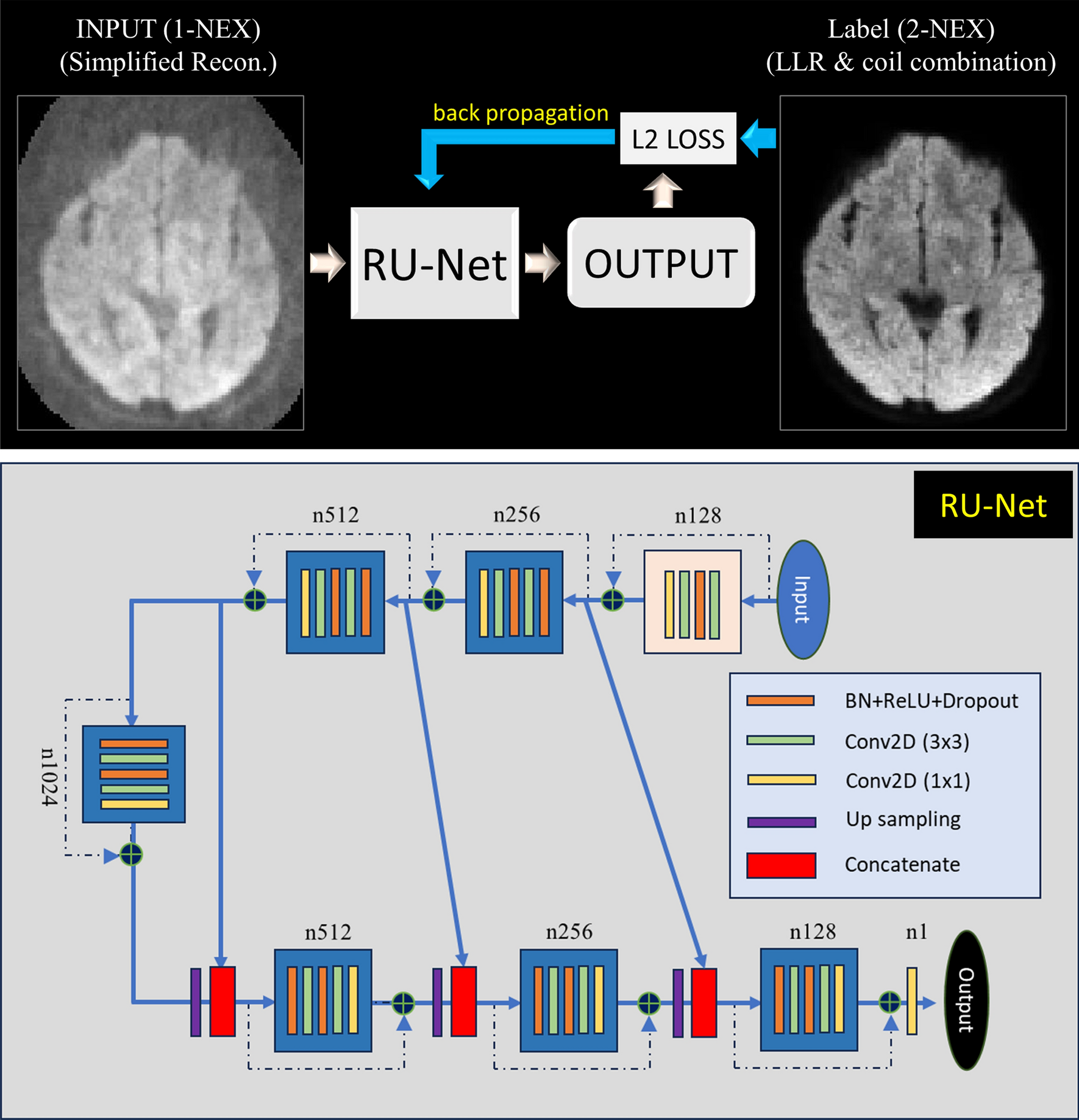 Improved reconstruction for highly accelerated propeller diffusion 1.5 T clinical MRI