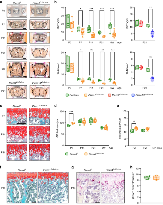 Piezo1 expression in chondrocytes controls endochondral ossification and osteoarthritis development