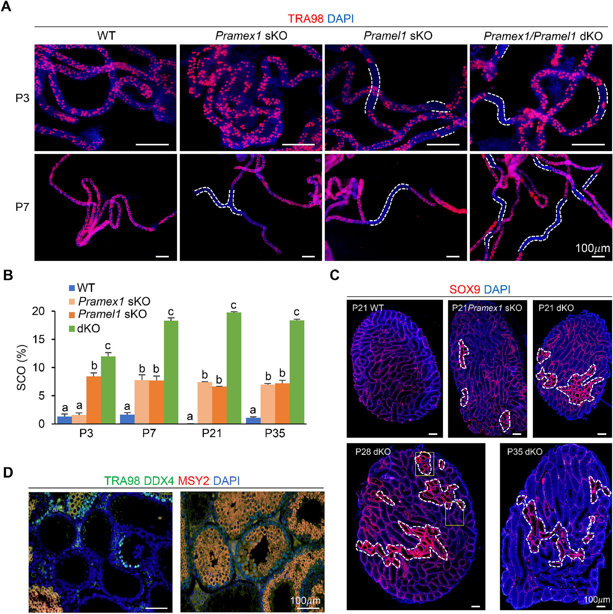 Synergistic enhancement of the mouse Pramex1 and Pramel1 in repressing retinoic acid (RA) signaling during gametogenesis