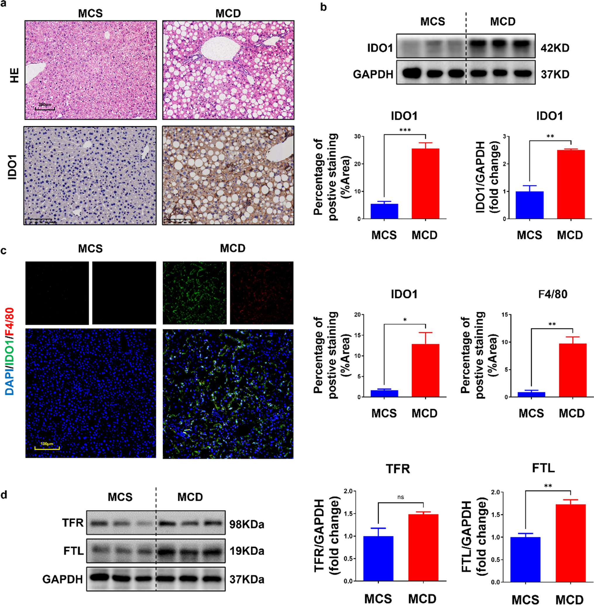 Indoleamine 2,3-dioxygenase 1-mediated iron metabolism in macrophages contributes to lipid deposition in nonalcoholic steatohepatitis