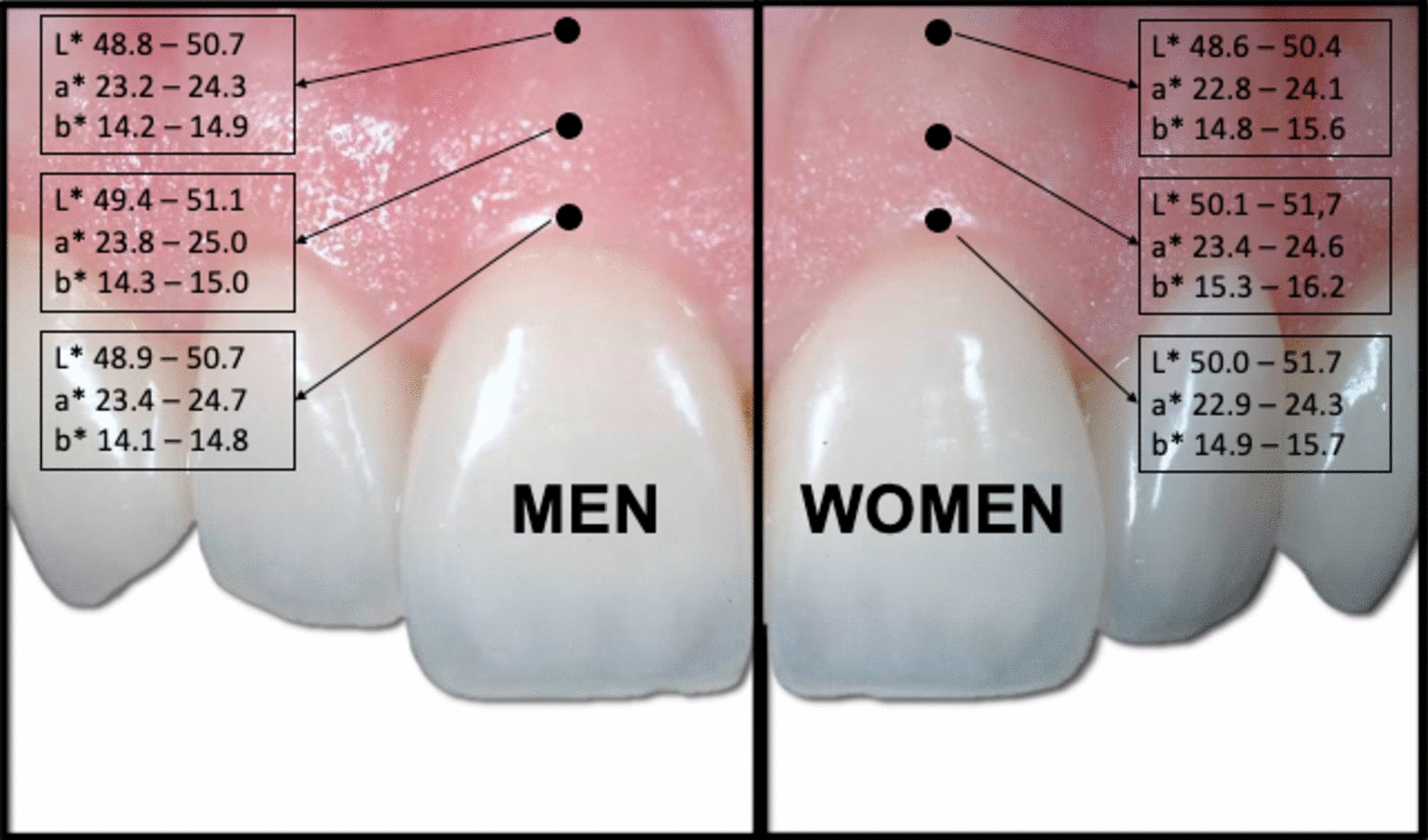 Explaining the colour of natural healthy gingiva