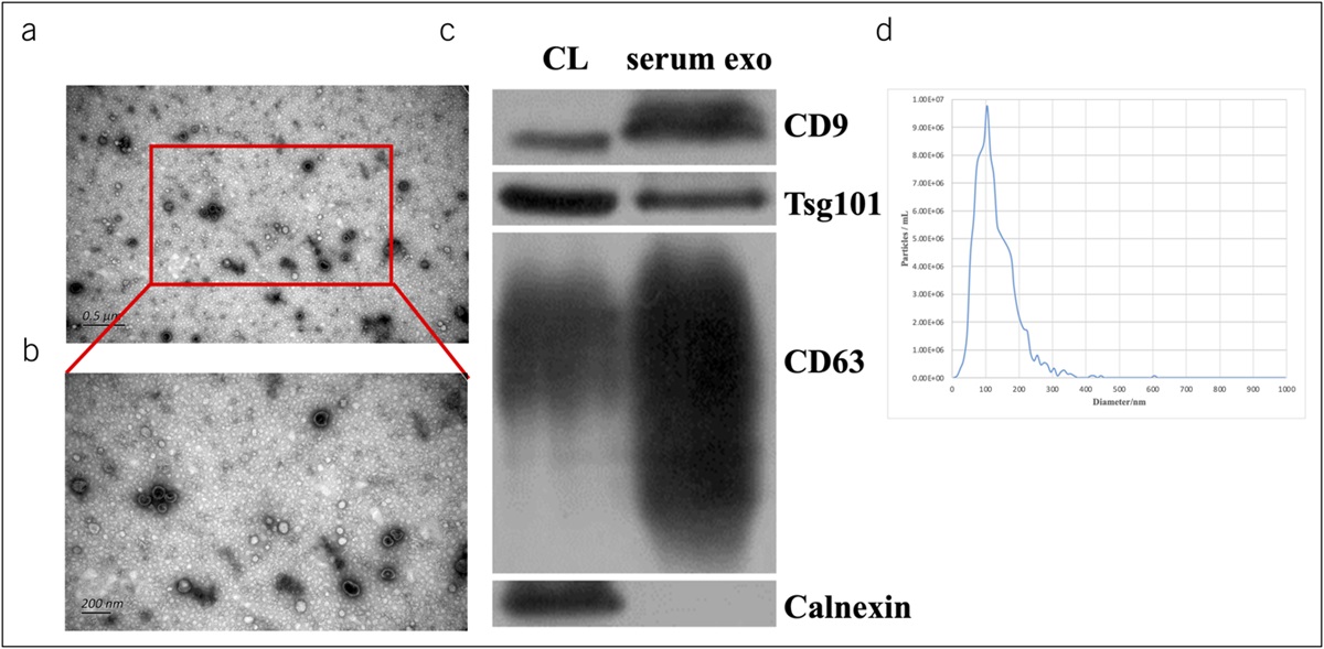 Serum Exosome–Derived microRNA-193a-5p and miR-381-3p Regulate Adenosine 5'-Monophosphate–Activated Protein Kinase/Transforming Growth Factor Beta/Smad2/3 Signaling Pathway and Promote Fibrogenesis
