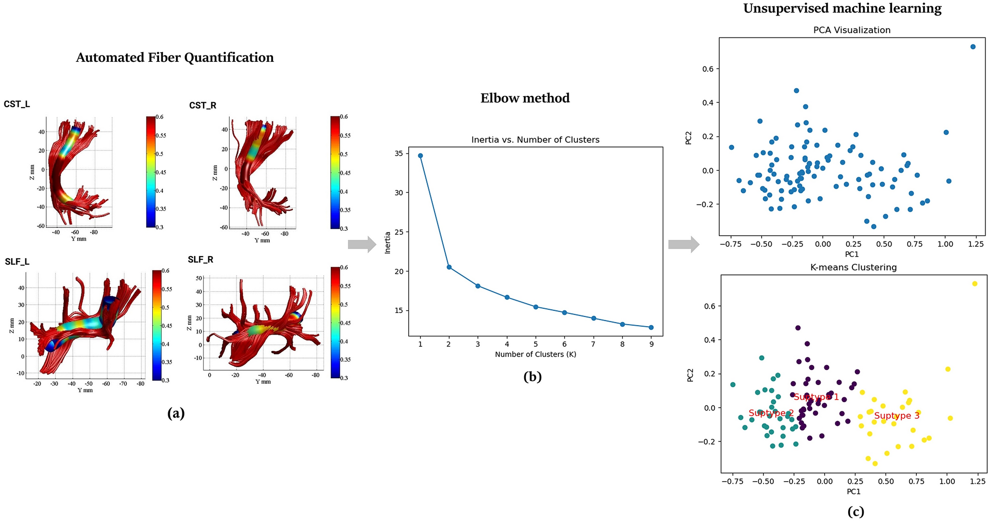 Exploring subtypes of multiple sclerosis through unsupervised machine learning of automated fiber quantification