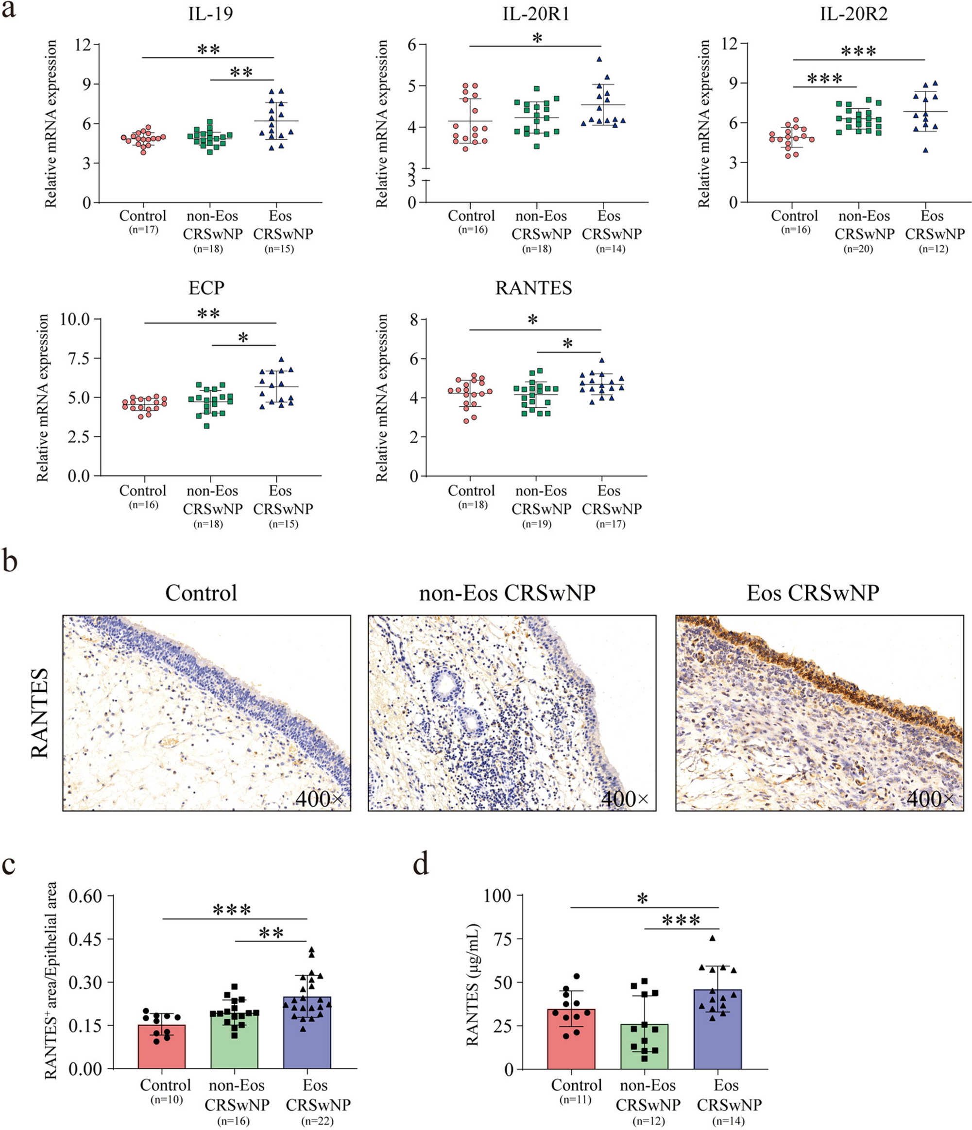 Interleukin-19 enhances eosinophil infiltration through upregulation of epithelium-derived RANTES expression via the ERK/NF-κB signalling pathway in patients with eosinophilic CRSwNP