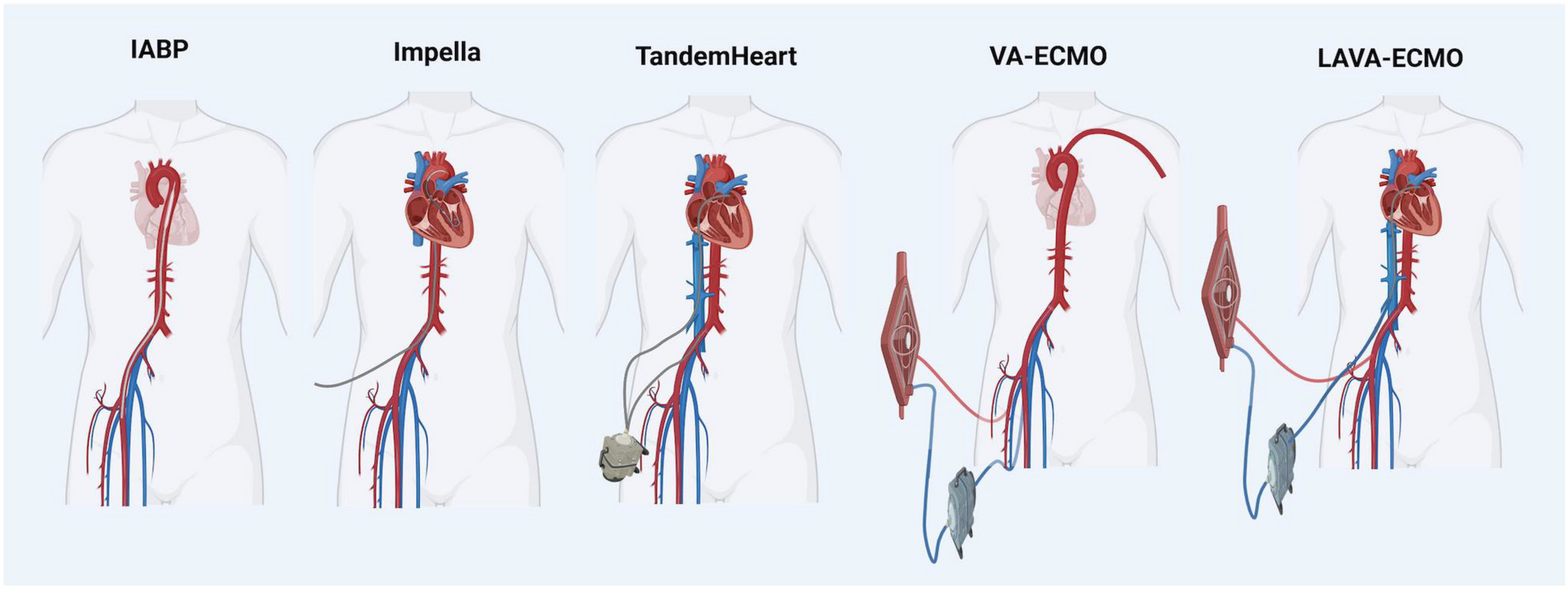 Mechanical Circulatory Support for High-Risk Percutaneous Coronary Intervention