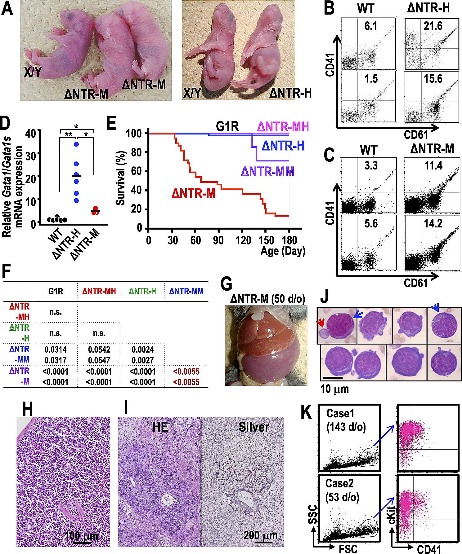 The abundance of the short GATA1 isoform affects megakaryocyte differentiation and leukemic predisposition in mice