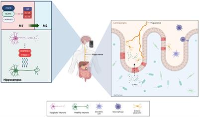 Transcutaneous vagus nerve stimulation: a new strategy for Alzheimer’s disease intervention through the brain-gut-microbiota axis?