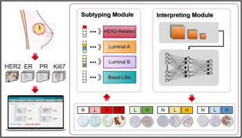 A deep learning based holistic diagnosis system for immunohistochemistry interpretation and molecular subtyping