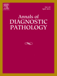 Esophageal adenocarcinoma heterogeneity in clinicopathology and prognosis: A single center longitudinal study of 146 cases over a 20-year period