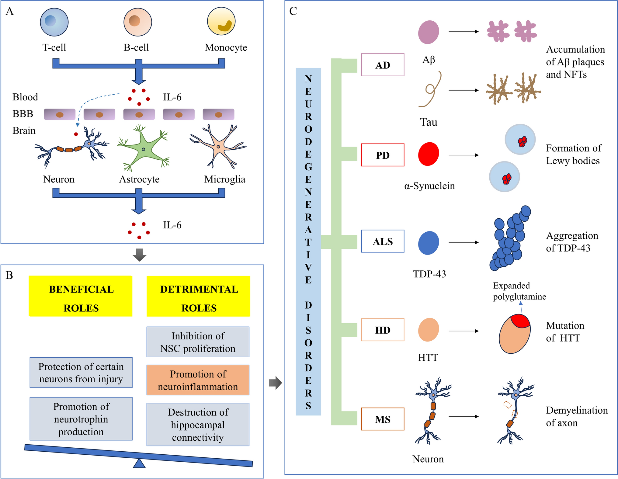 The Role of IL-6 in Neurodegenerative Disorders