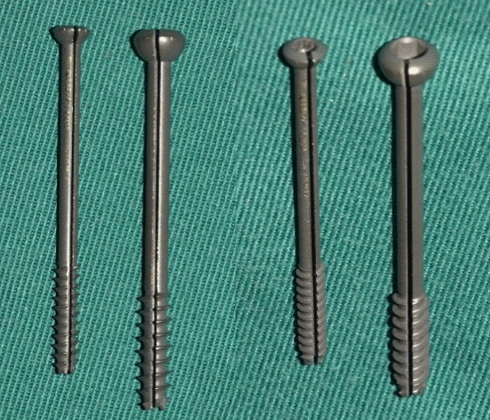 Two-step osteotomy/discectomy through cannulated screw (TOCS) technique for en bloc resection of spine tumor: surgical technique and preliminary results