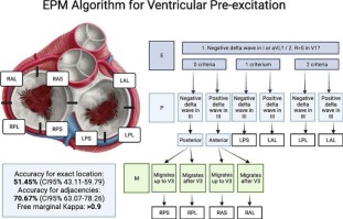 EPM algorithm: A stepwise approach to accessory pathway localization in ventricular pre-excitation