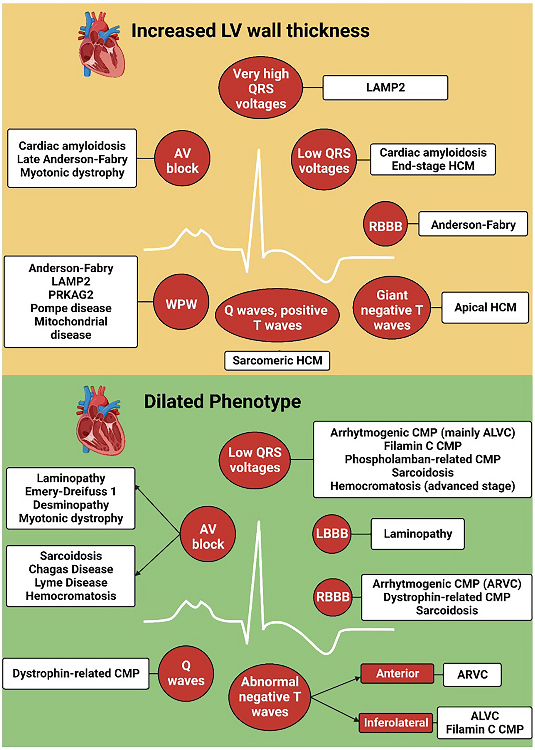 Electrocardiographic abnormalities in patients with cardiomyopathies