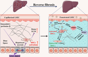 Engineered liposomes targeting hepatic stellate cells overcome pathological barriers and reverse liver fibrosis