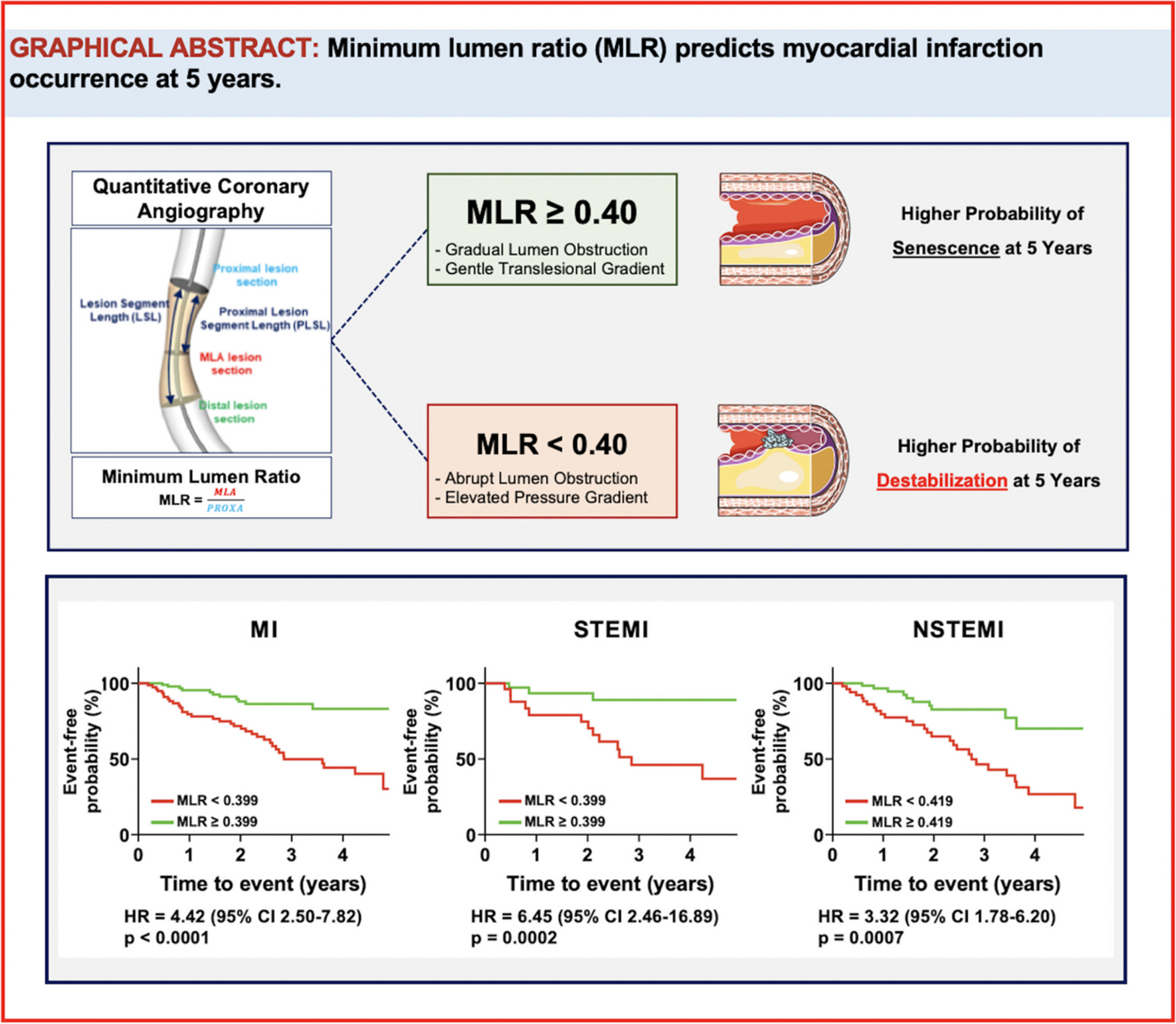 Association Between Automated 3D Measurement of Coronary Luminal Narrowing and Risk of Future Myocardial Infarction