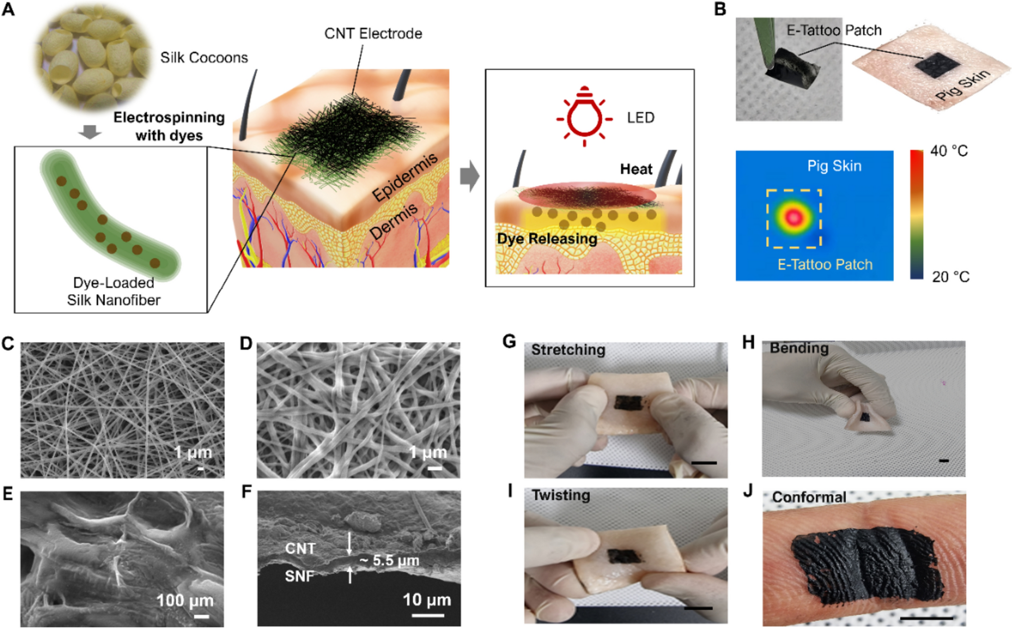 Ultrathin silk nanofiber–carbon nanotube skin tattoos for wirelessly triggered and temperature feedbacked transdermal drug delivery