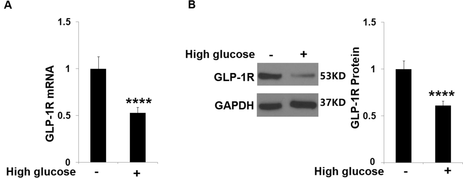 Liraglutide prevents cellular senescence in human retinal endothelial cells (HRECs) mediated by SIRT1: an implication in diabetes retinopathy