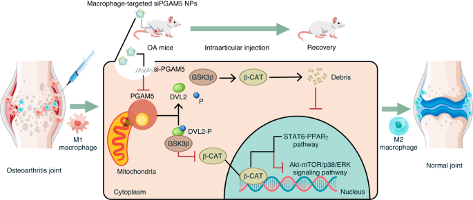 Targeted knockdown of PGAM5 in synovial macrophages efficiently alleviates osteoarthritis