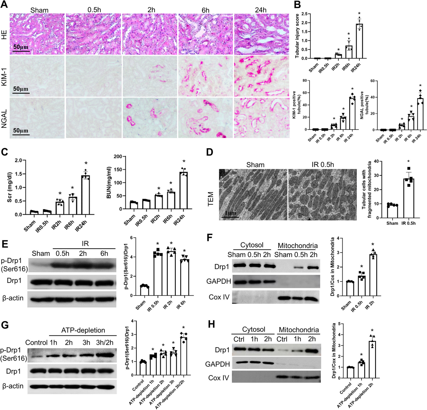 Inhibition of Drp1- Fis1 interaction alleviates aberrant mitochondrial fragmentation and acute kidney injury