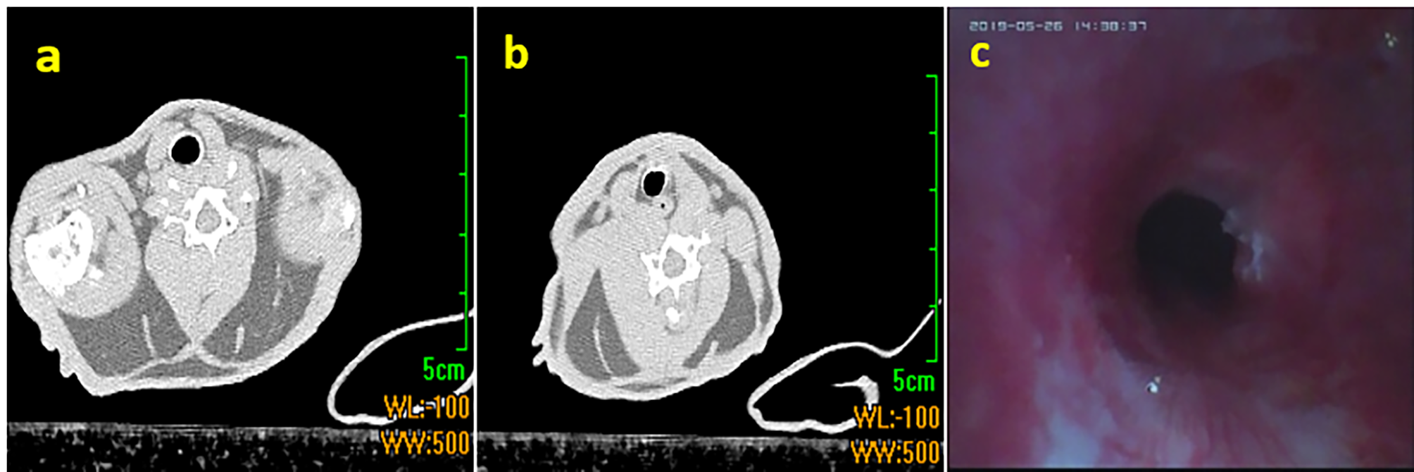Study on the rationality of small diameter metallic airway stent in treatment of tracheal stenosis in injured rabbits