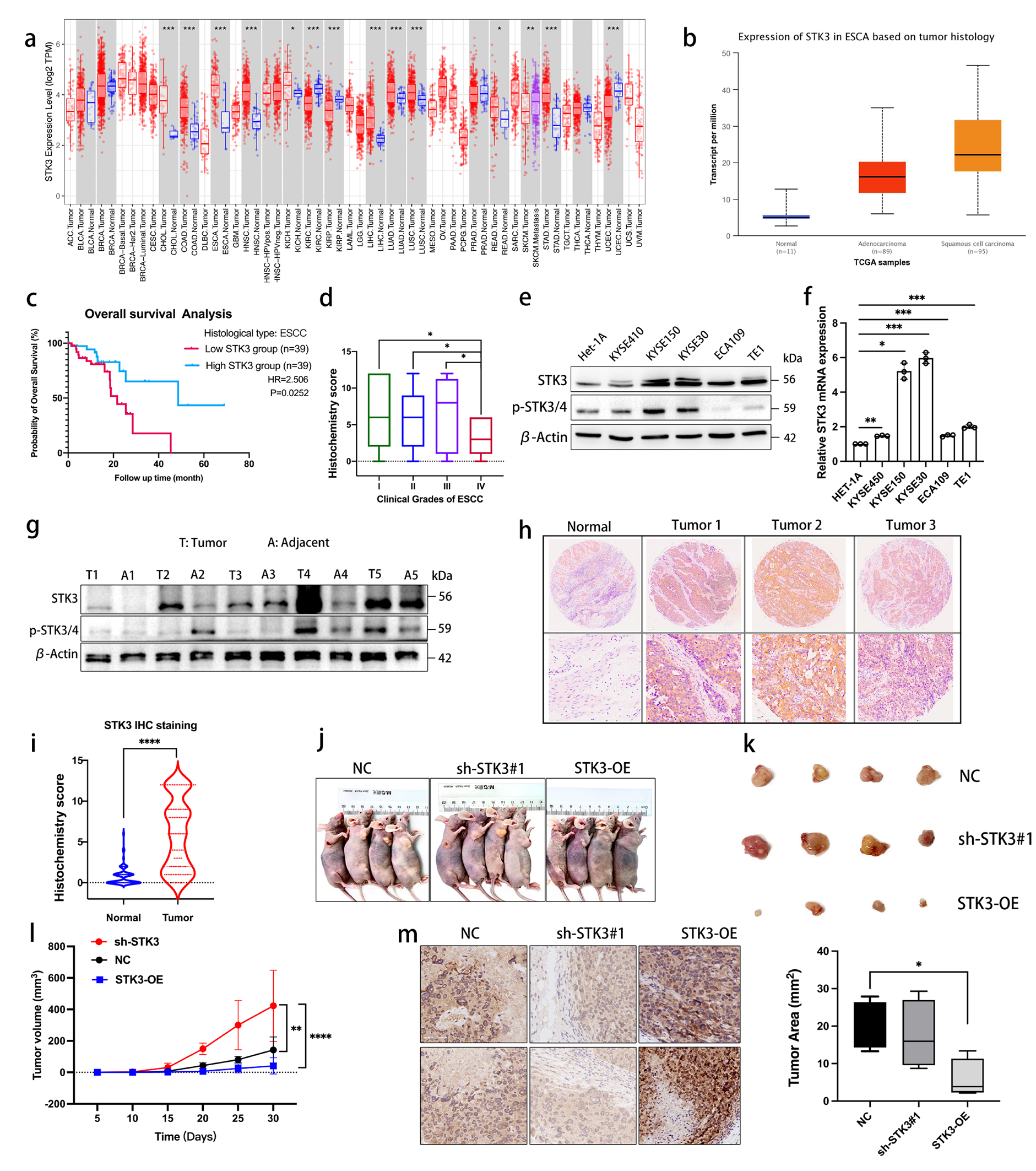 STK3 kinase activation inhibits tumor proliferation through FOXO1-TP53INP1/P21 pathway in esophageal squamous cell carcinoma