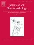 Electronic ventricular pacing at the end of the QRS complex: Is it abnormal?
