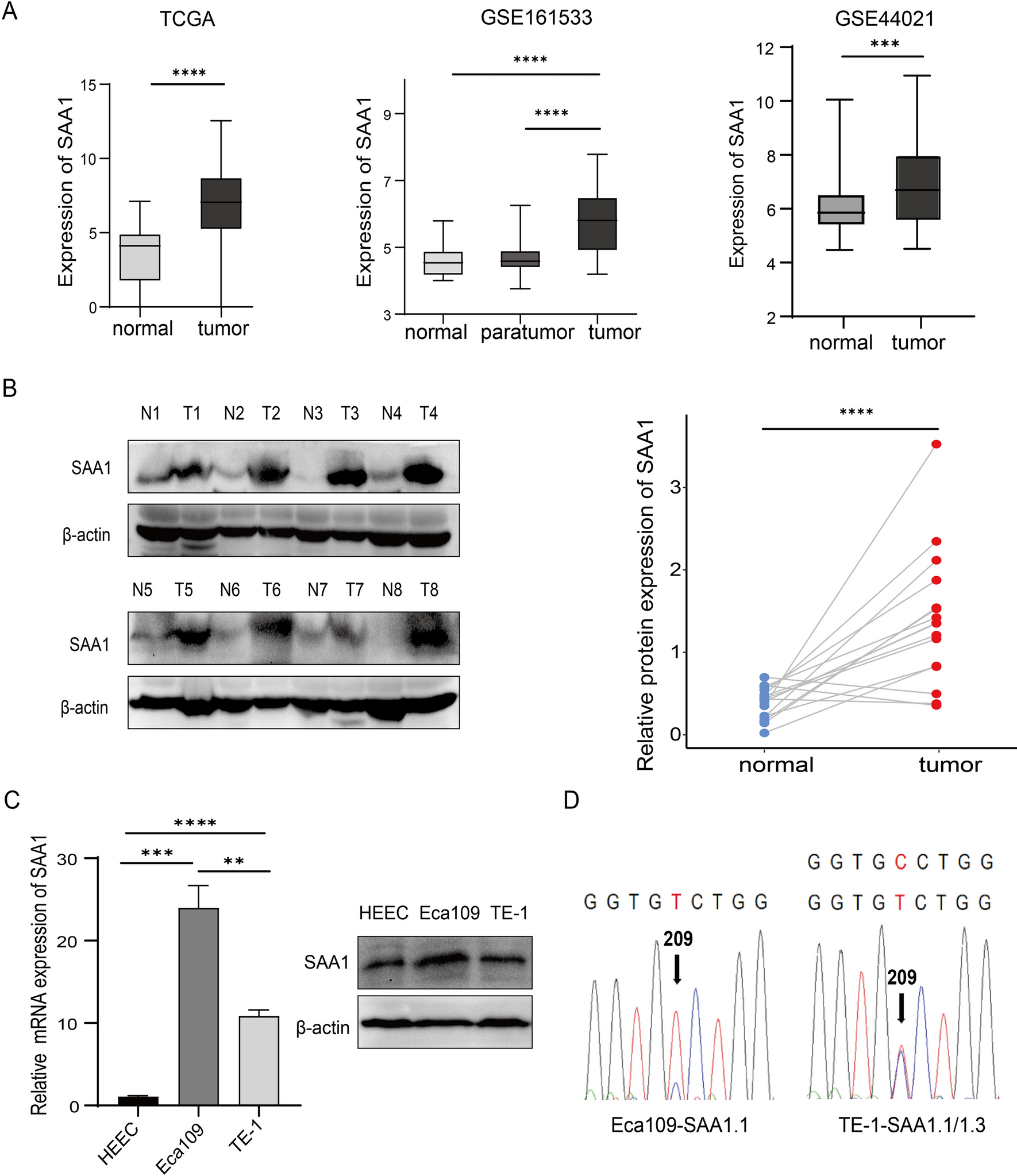 SAA1 regulated by S1P/S1PR1 promotes the progression of ESCC via β-catenin activation