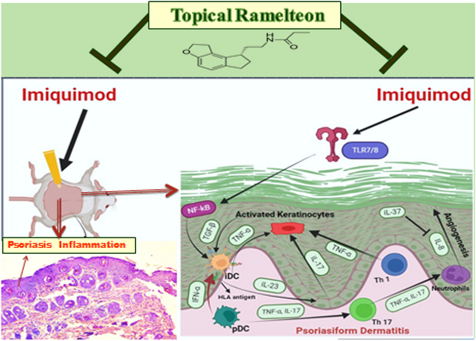 Ameliorative effects of topical ramelteon on imiquimod-induced psoriasiform inflammation in mice