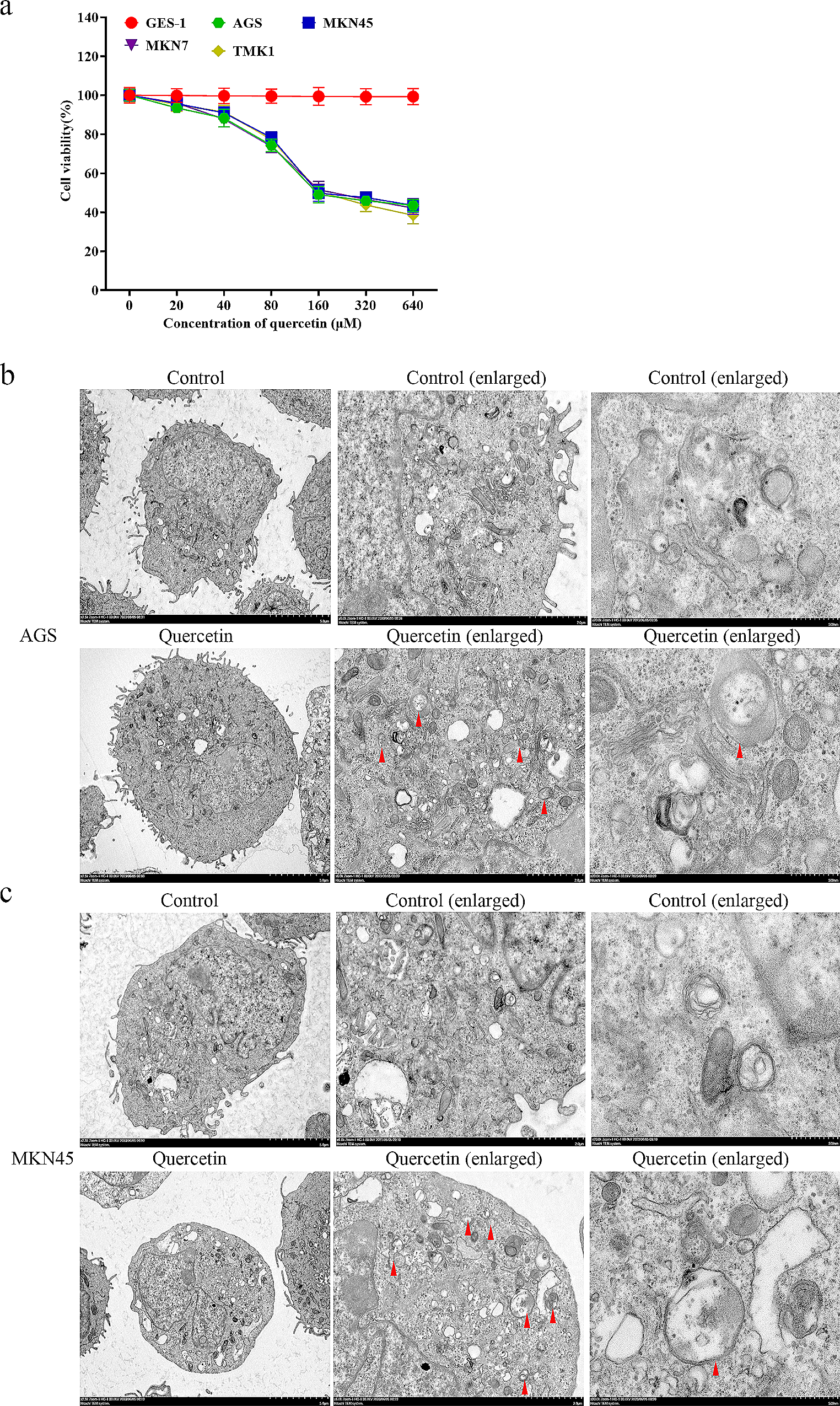 Quercetin promotes ATG5-mediating autophagy-dependent ferroptosis in gastric cancer